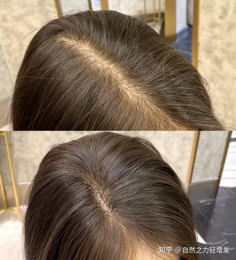 如何让头发变浓密