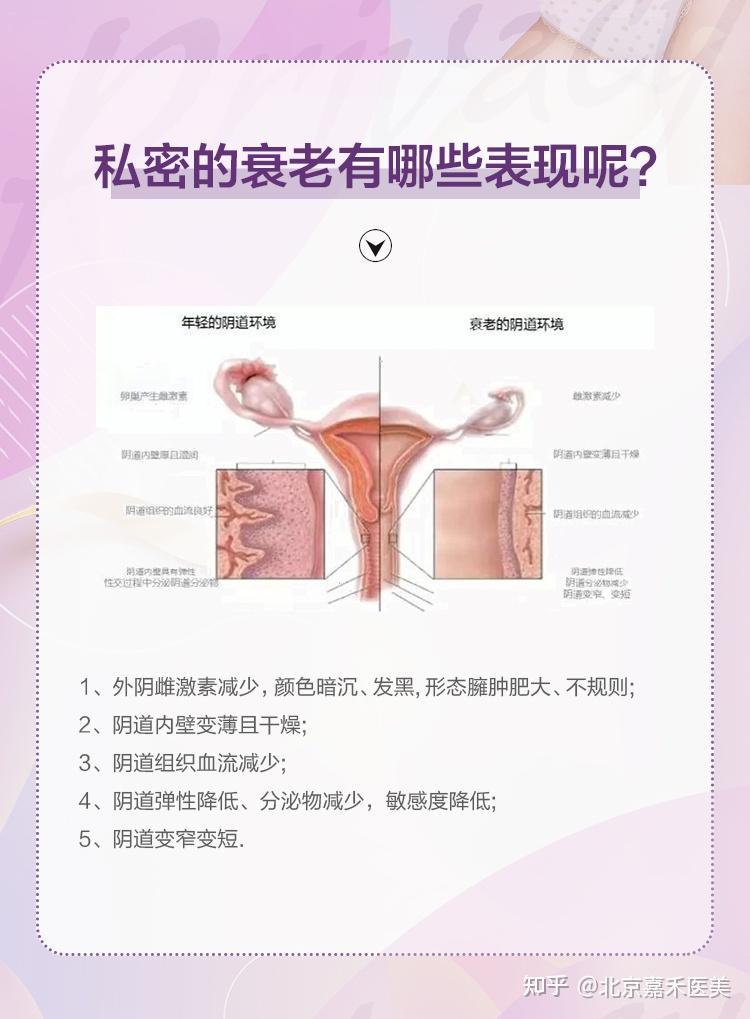 私密部位与面部一样也会衰老吗? - 知乎