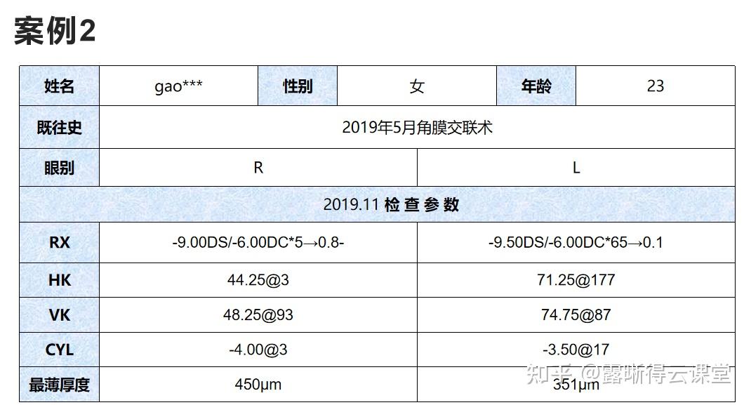 圆锥角膜的RGP验配及RGP临床效果分析（文字版） - 知乎