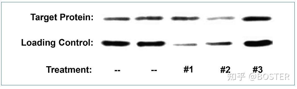 Western blot 如何正确选用内参抗体 - 知乎