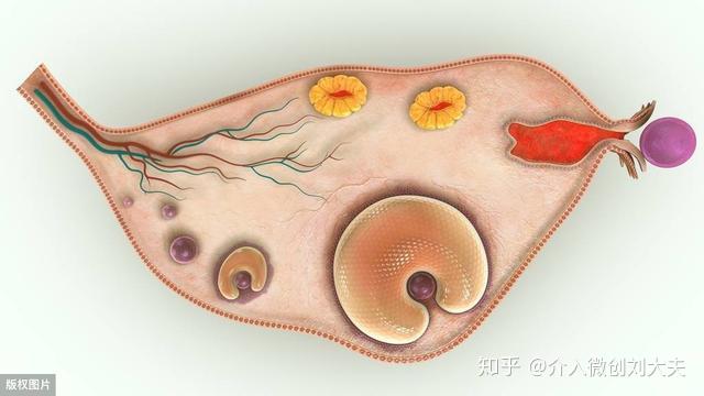 巧克力囊肿不同微创治疗方式与疗效对比分析