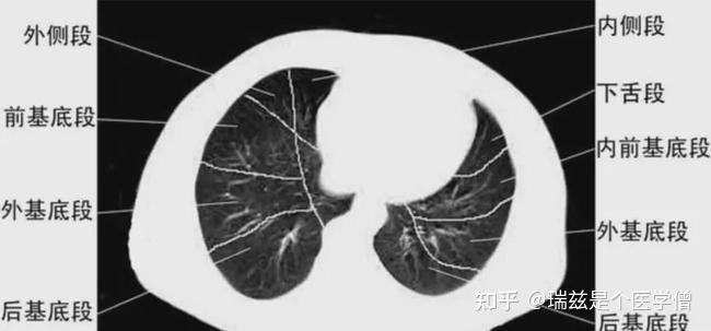 CT报告怎么看?3分钟教你读懂! - 知乎