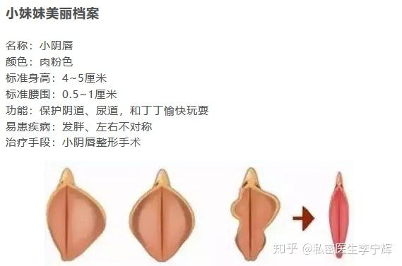 小阴唇肥大是自慰引起的 知乎