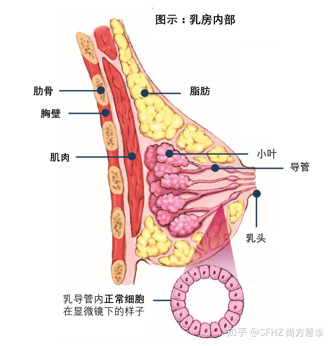 一文读懂乳腺癌的病理报告
