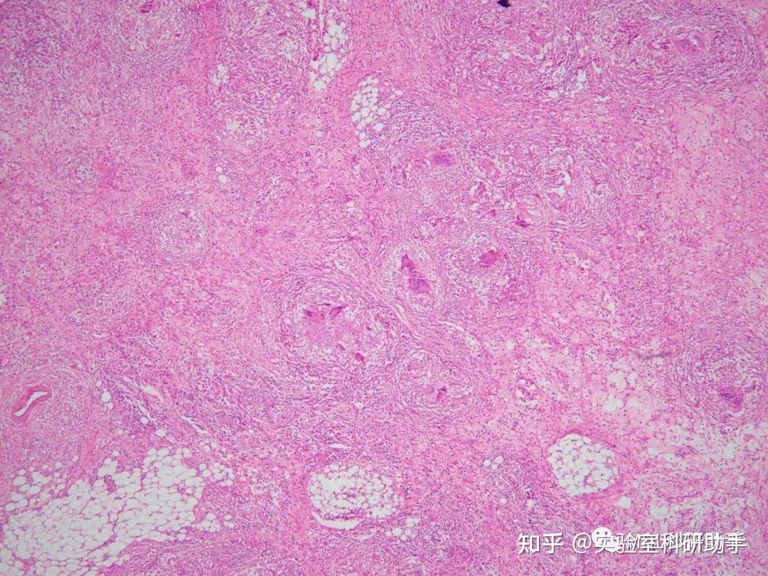 切片学习 | 常规病理组织切片及诊断要点 - 知乎