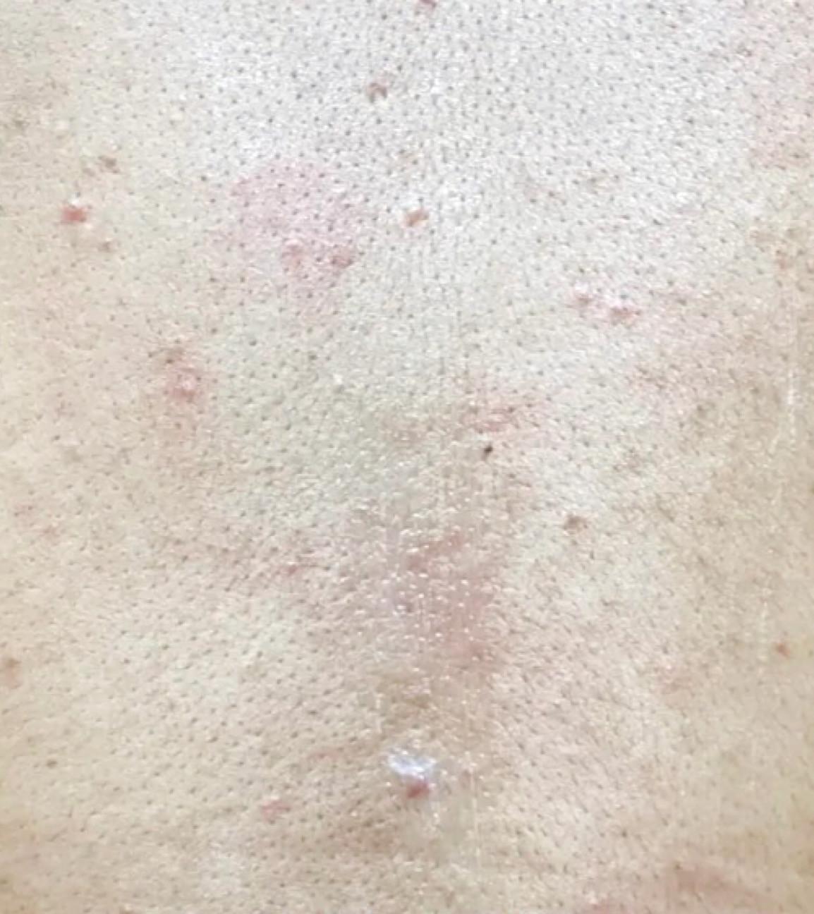 强烈推荐后背长痘痘或者起鸡皮的男生们用下这款沐浴露!