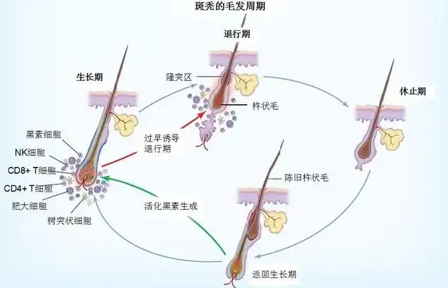 为什么总说秃头男却很少说秃头女？ - 知乎