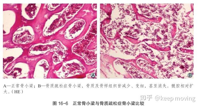 骨组织结构及骨质疏松模型 - 知乎