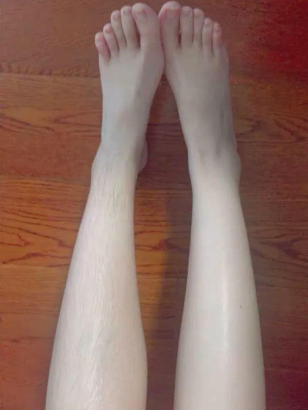 腿毛长的女生一定要脱毛吗?