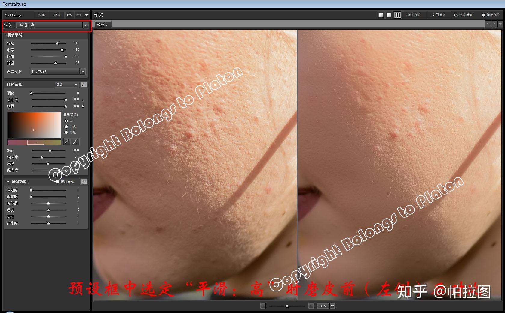 面部皮肤护理。面部水微晶磨皮脱皮治疗照片摄影图片_ID:141661447-Veer图库