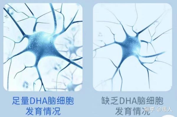 儿童到底要不要补DHA？是智商税吗？哪些DHA值得推荐