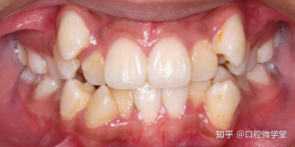 牙弓间,颌骨间关系不调;牙颌,颅面的关系不调,具体