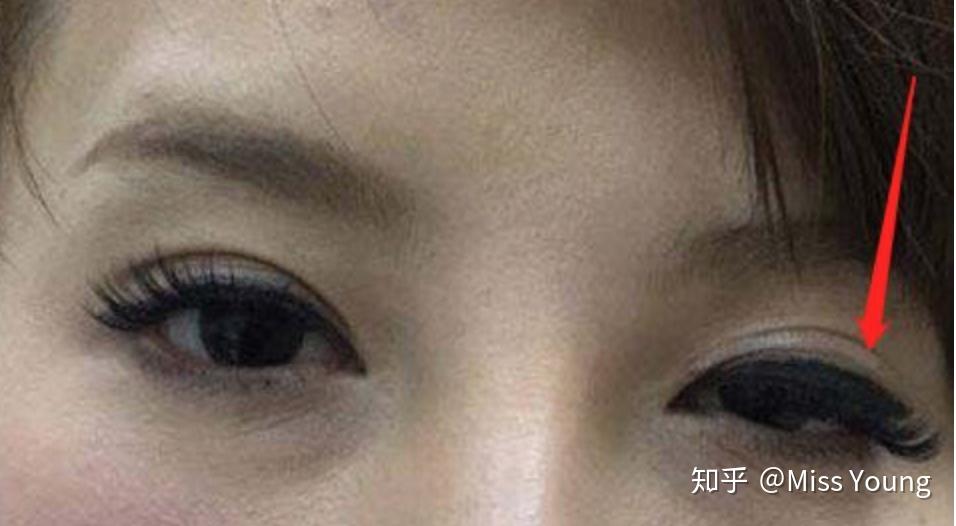 赘肉溢出裙子的杨紫怎么复胖成这样了难道她不知道它不仅让眼睛变大