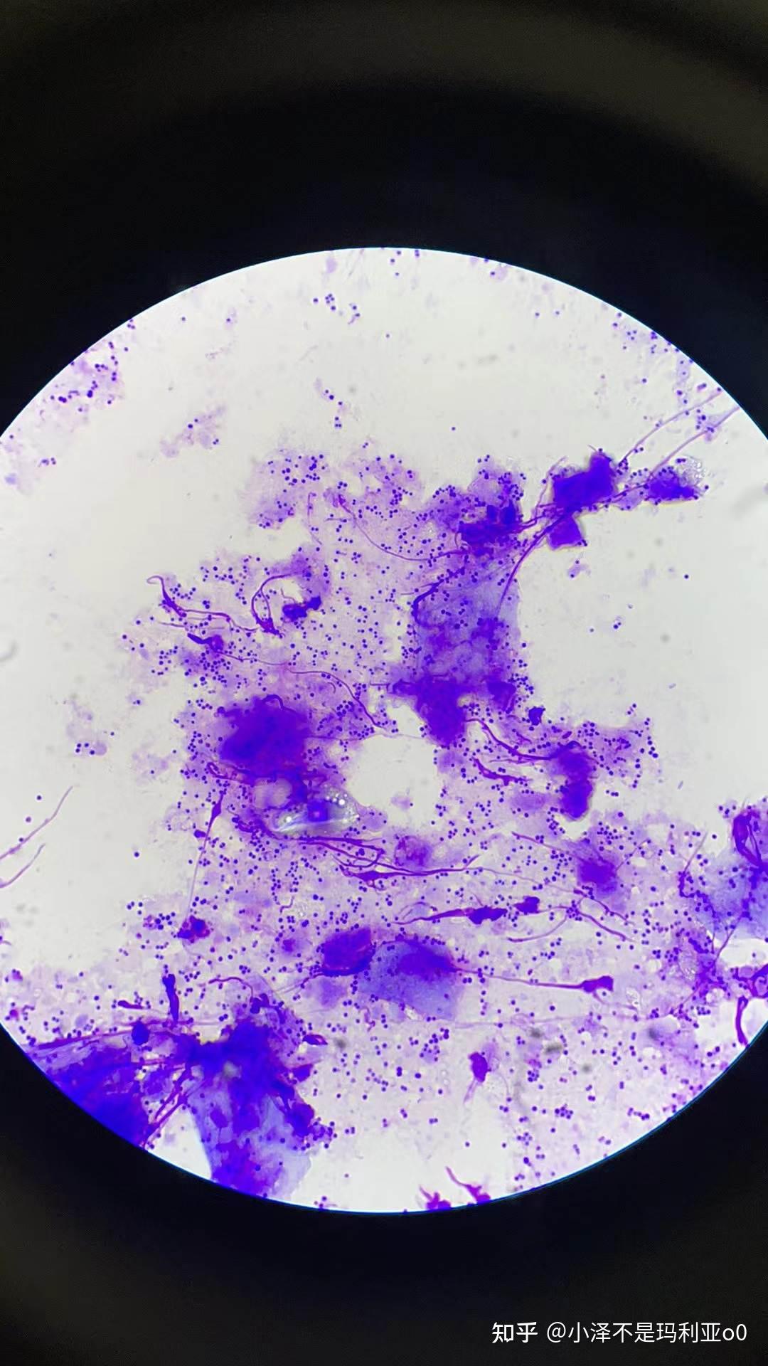 耳朵就发现有黑褐色的分泌物,我带去检查过之后,显示是马拉色菌,所以