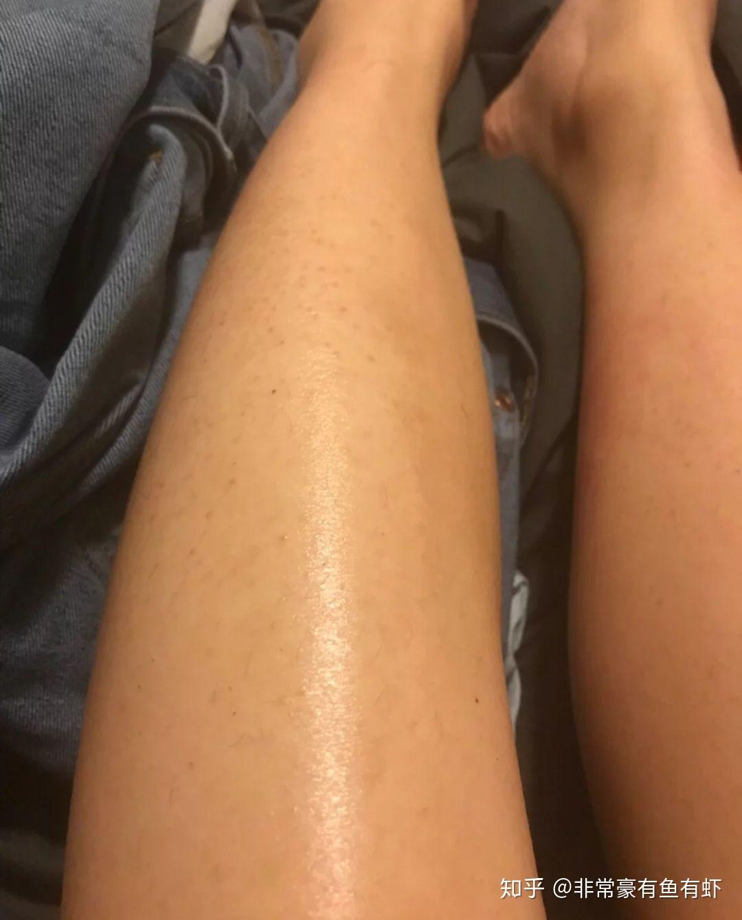 鸡皮肤可以去除么(鸡皮肤可以去除么图片) 鸡皮肤可以去除么(鸡皮肤可以去除么图片)