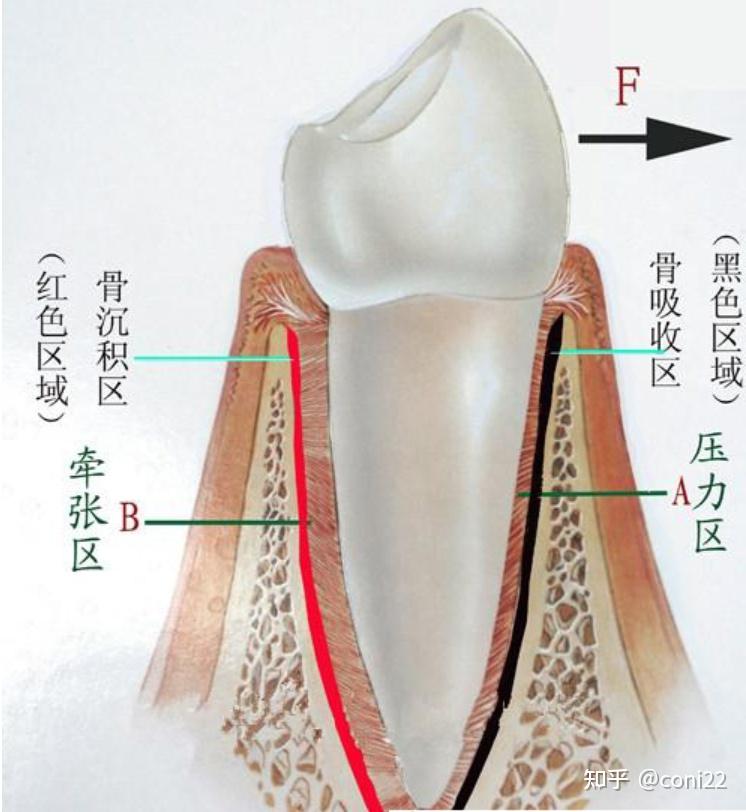 正畸的基础支撑——牙槽骨的改建