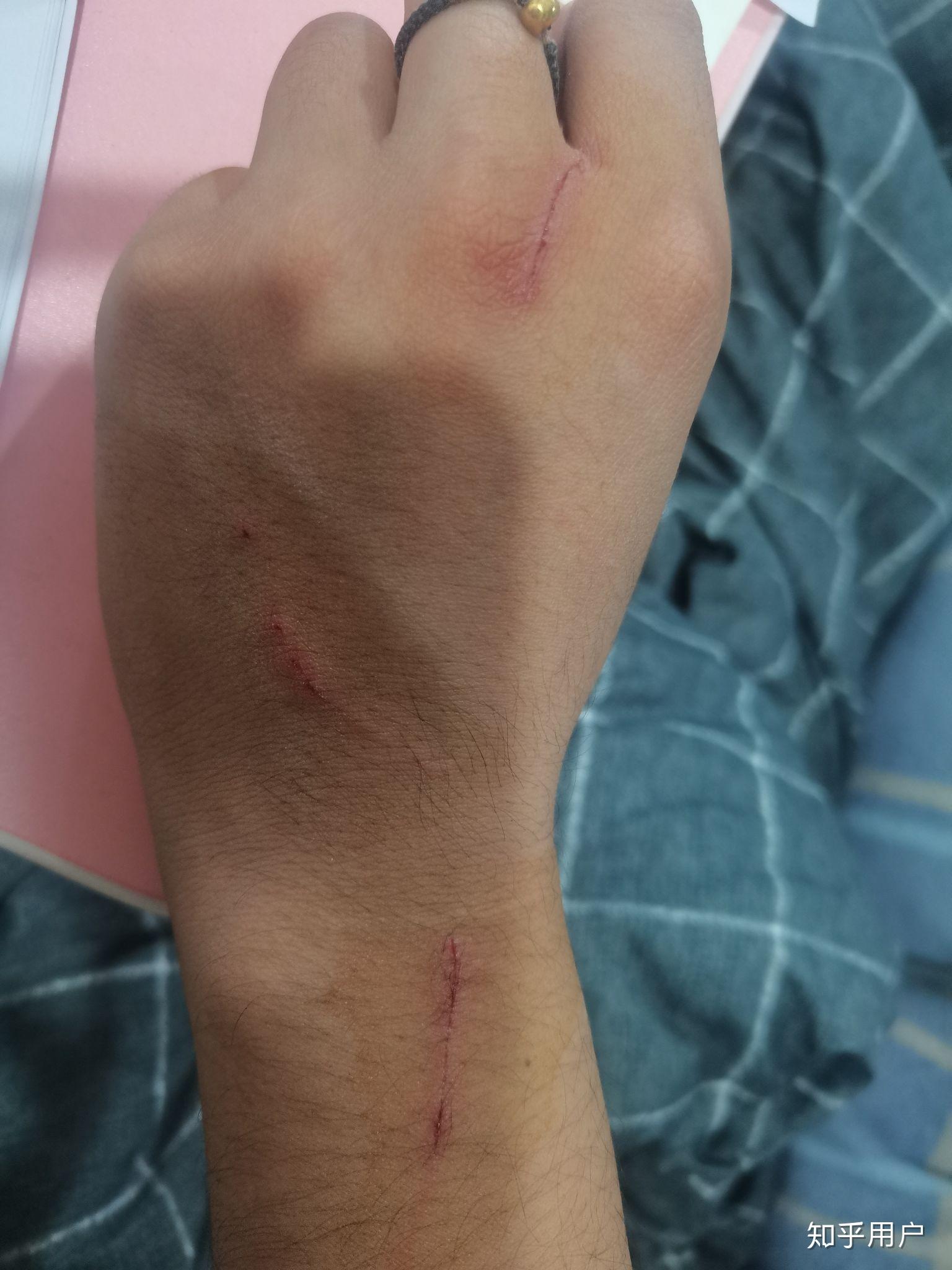 自己好吃好喝待着的猫抓了满身伤还该不该对它好