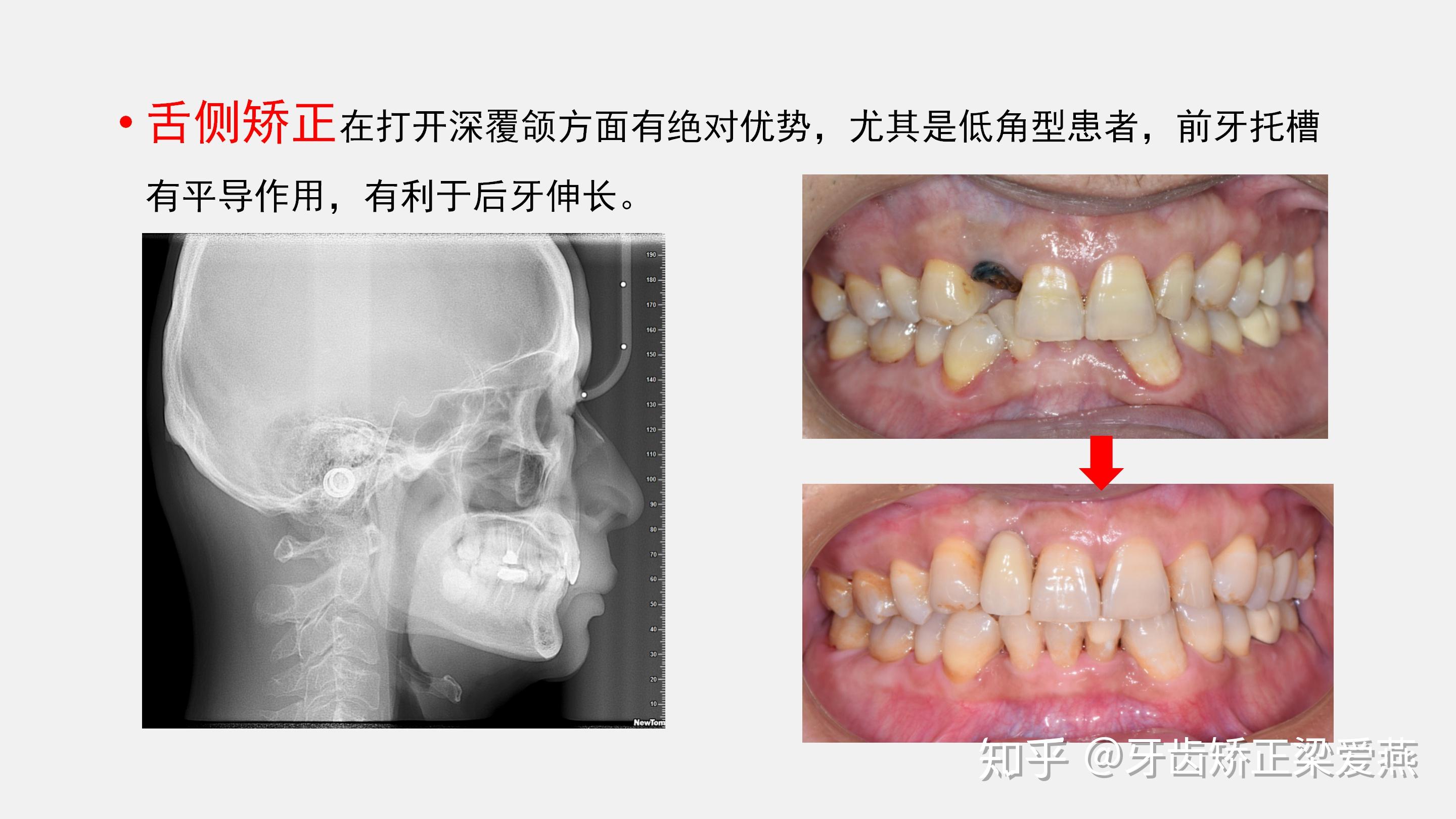 舌弓指图片