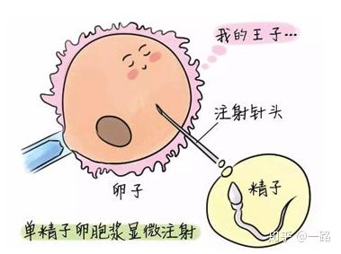 试管婴儿的挑战