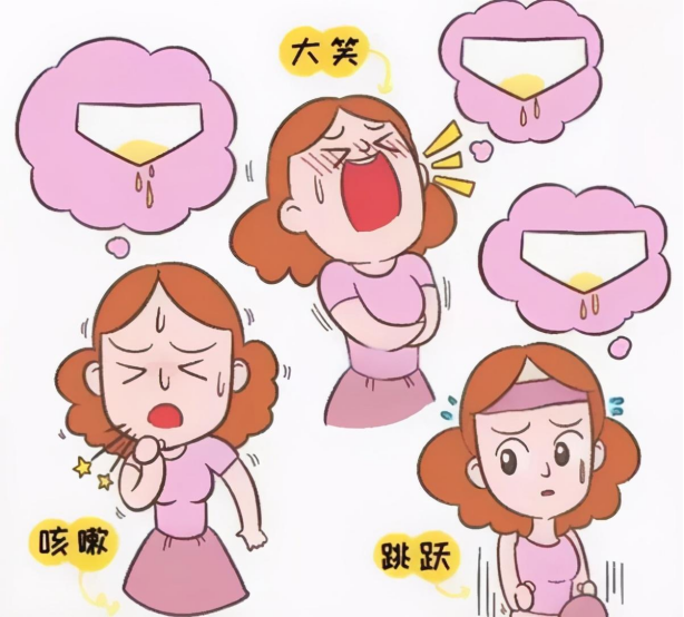 产后漏尿怎么办?女性终生需练-盆底肌 - 知乎