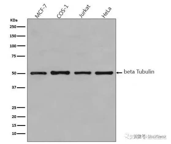 Western Blot 中如何选择内参抗体? - 知乎
