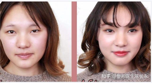 如何辨别自己是内双眼皮,怎么做才能变成双眼皮 - 知乎