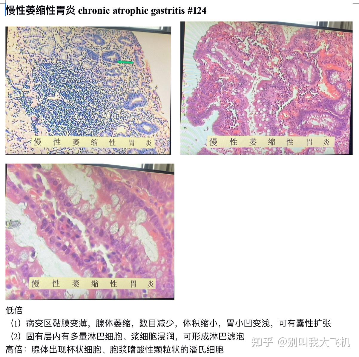 病理实验切片红蓝铅笔绘图