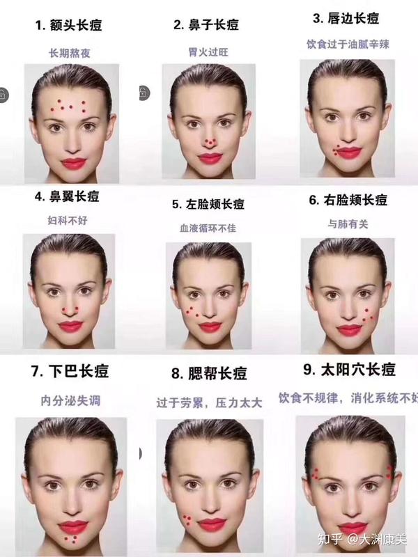 下巴上长痘痘是身体哪里有问题 下巴长痘按摩那里 Urpimp网
