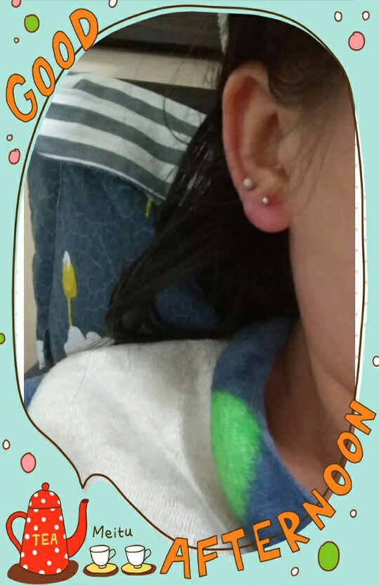 打耳洞如何护理能避免发脓红肿?另外我也很想