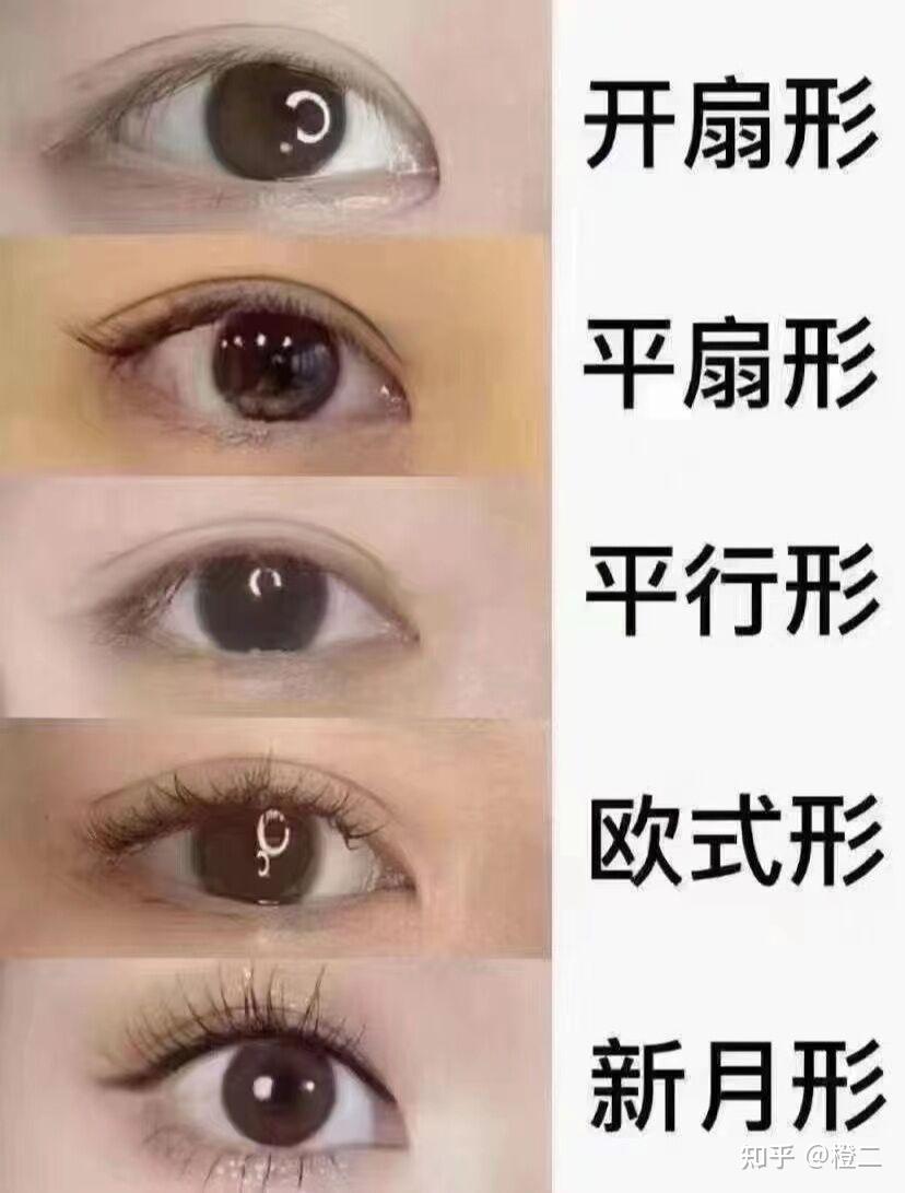 双眼皮术前超全攻略|内行人才知道的秘密,割双眼皮必看!