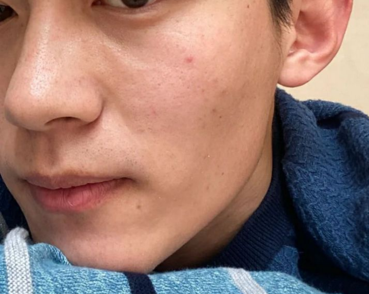 男士面部肤色偏黑,怎么美白?用什么产品好?