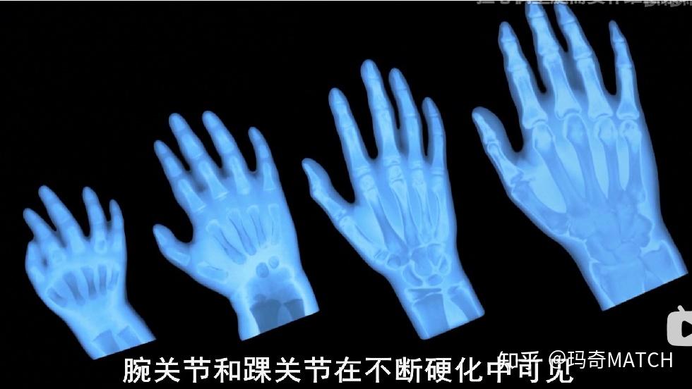骨生长发育 骨龄
