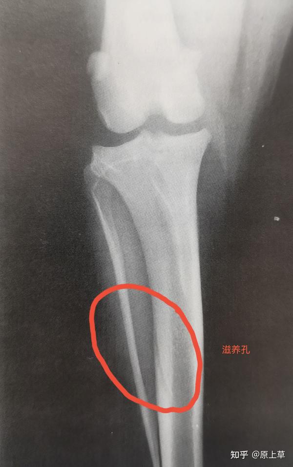 X光片上骨头的结构 - 知乎