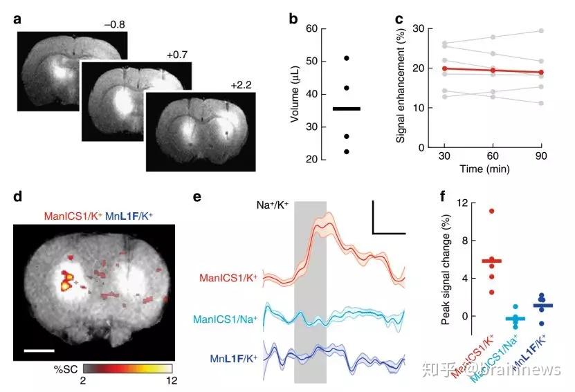 Nature：新型MRI造影剂助力更精确的神经元活动的空间和时间定位 - 知乎