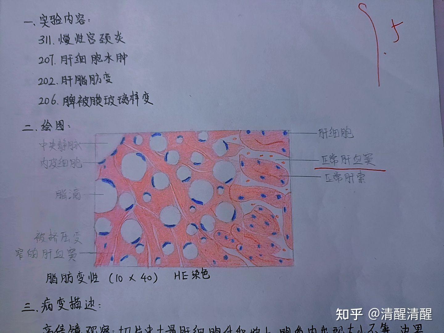 异物肉芽肿红蓝图片