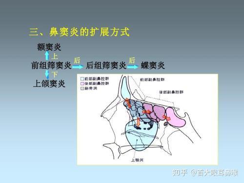 首大宋建伟治疗儿童鼻窦炎哪个方法合适