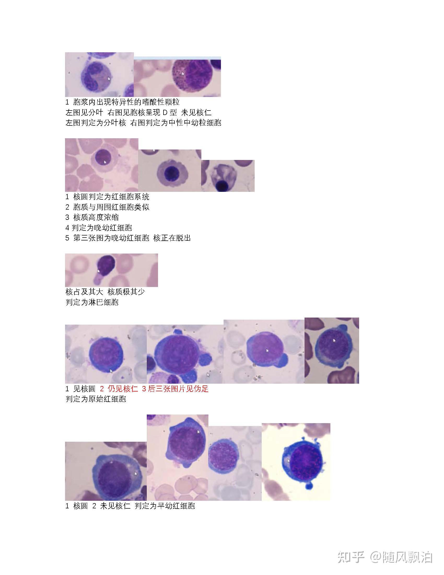 骨髓细胞和外周血细胞的识别(24个兄弟姐妹),诊断标本考试_哔哩哔哩
