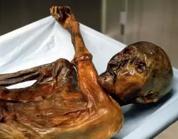 有哪些逆天的微生物? 8 v2 b562342da94d56962081be0afd2e14df 720w