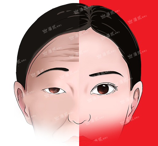 上面部眼眉额之非年轻化(上睑下垂、眼无神、抬头纹、额纹、高低眉等），可以通过双眼皮手术的切口改善？ - 知乎