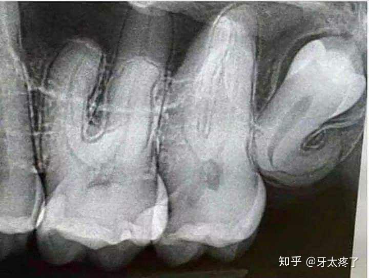 人口腔体积_人口腔上皮细胞图