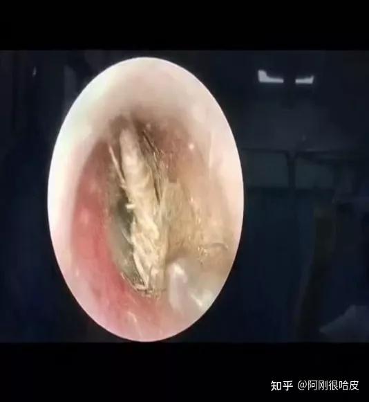 千万不要乱掏,以防造成更严重的后果!