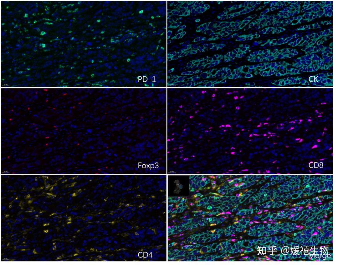 Treg-免疫抑制T细胞研究进展 - 知乎