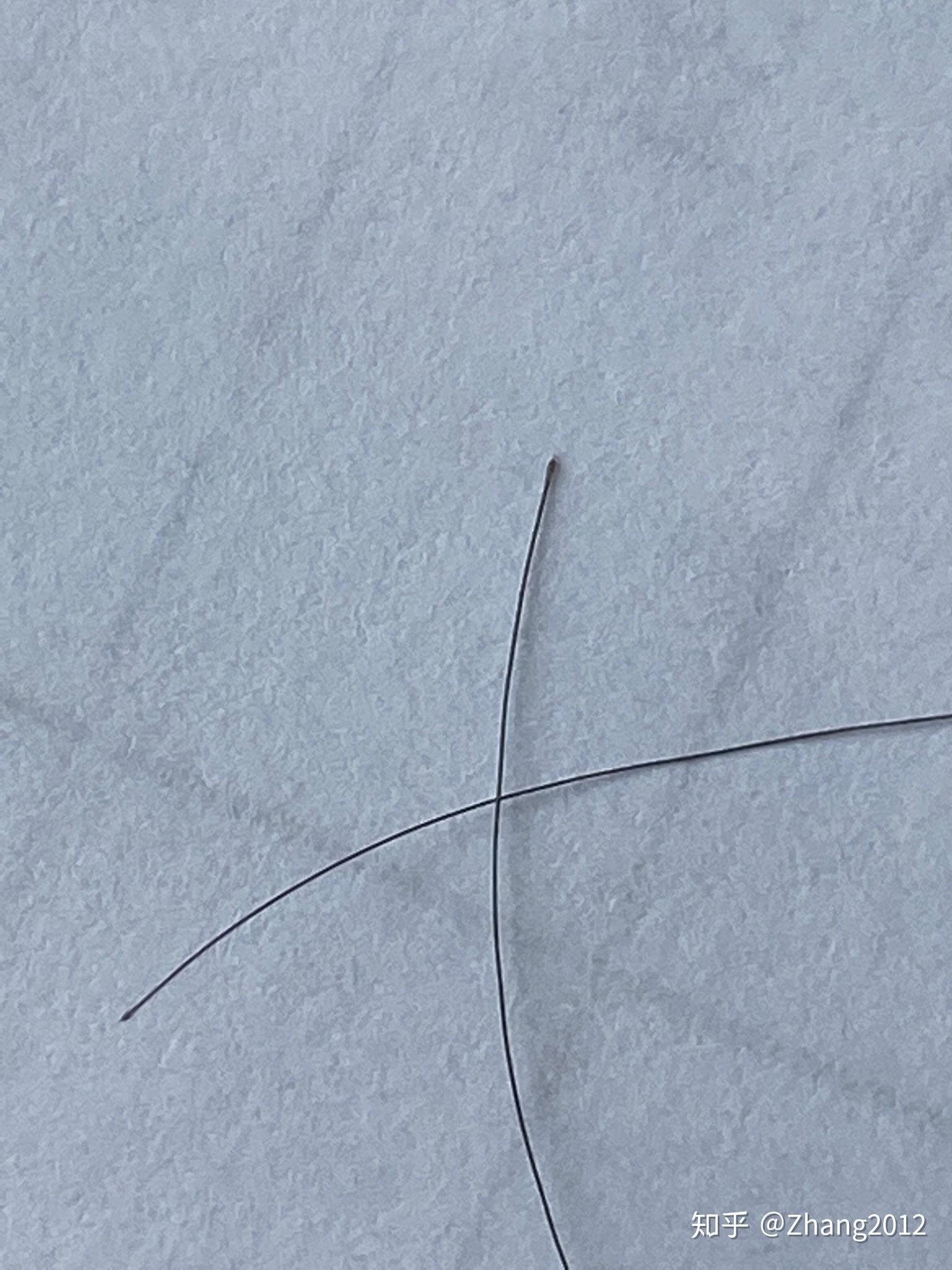 正常脱落的头发发根是什么样的