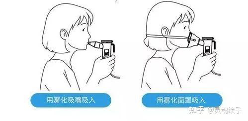咳嗽有痰要不要去做雾化,一篇文章看懂雾化治疗 - 知乎