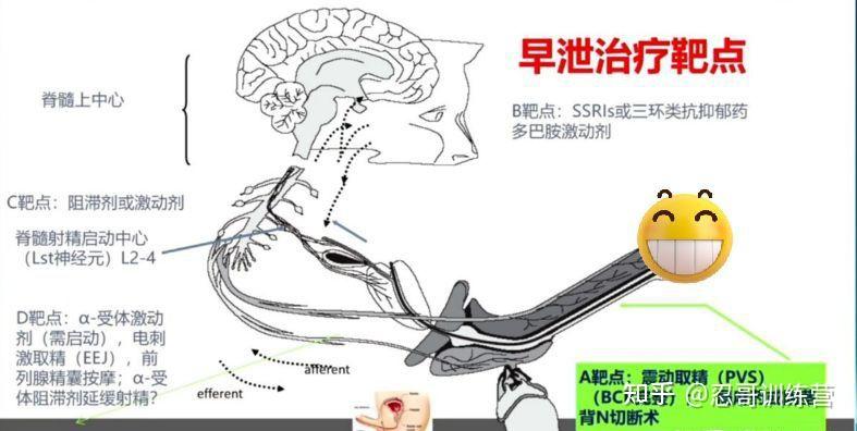 阴茎背神经阻断术——早泄治疗手术