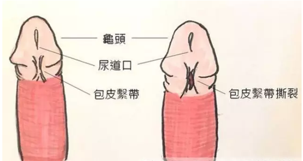 房事见红并非处女专利 男士不注意这几点也会有 知乎