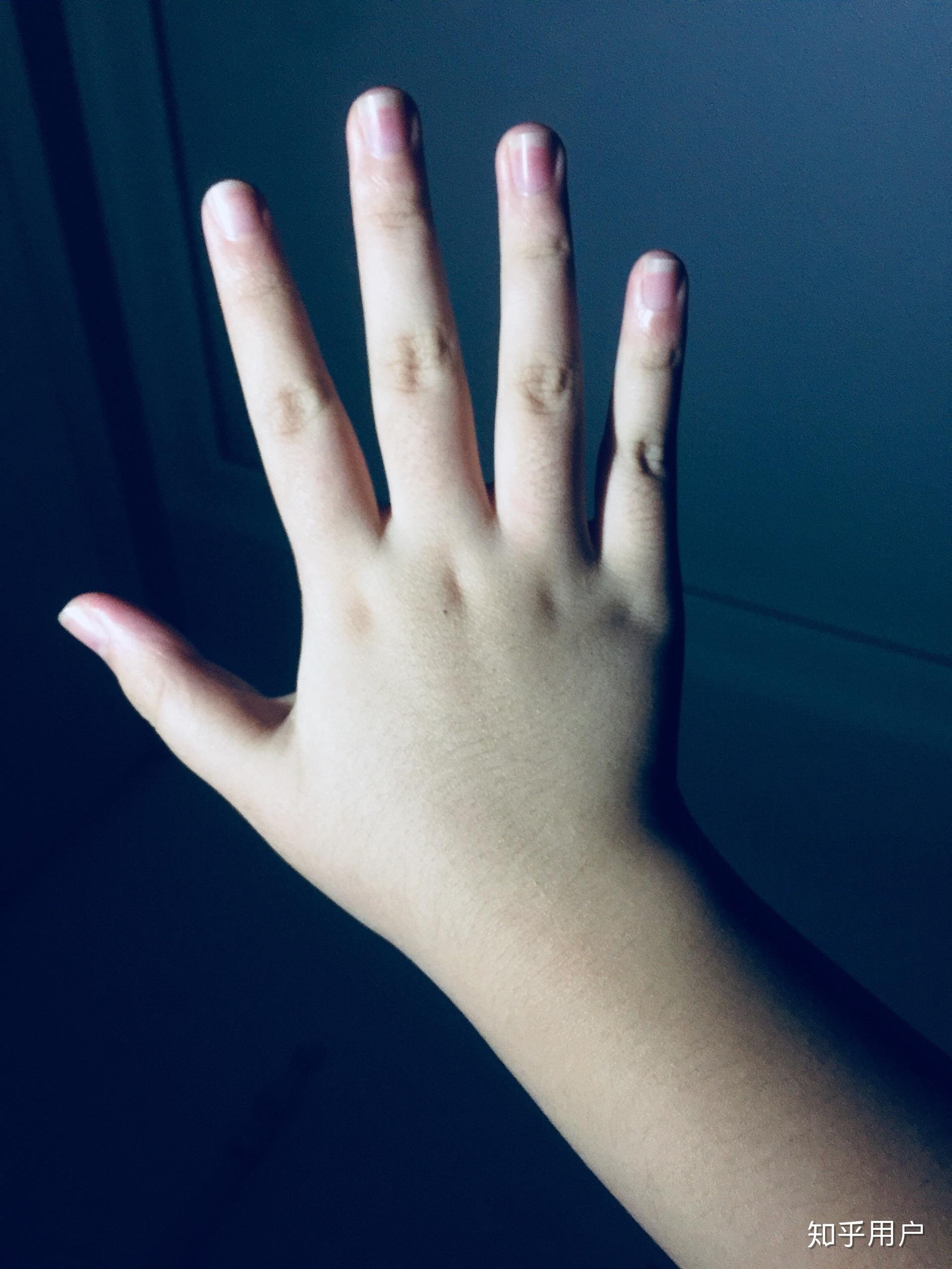 胖手胖脚是种什么体验