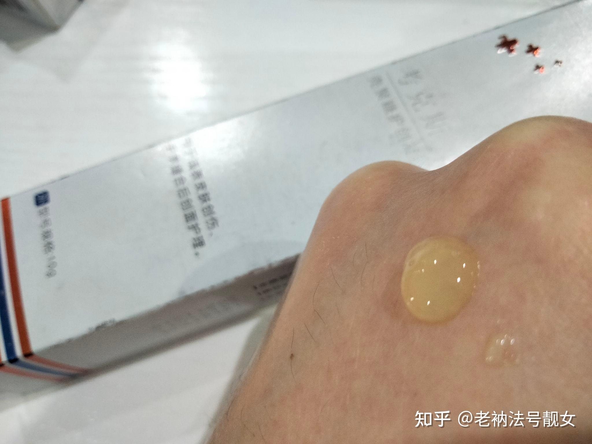 有什么巨好用的去痘印产品? - 知乎
