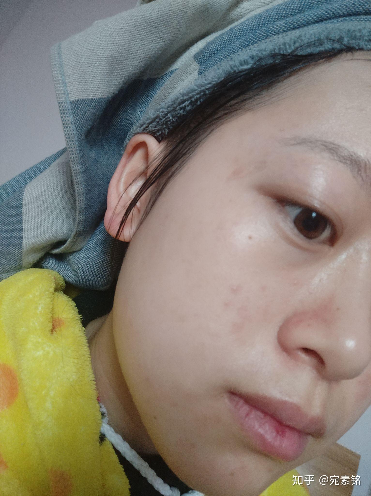 怎么快速解决嘴皮干 v2-b6d7ad23b29b77ee488039e4f104f1f1_r.jpg