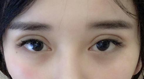 为什么割的双眼皮会显得假 知乎
